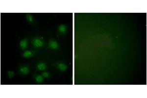 Immunofluorescence analysis of HuvEc cells, using NIFK (Phospho-Thr234) Antibody. (NIFK 抗体  (pThr234))