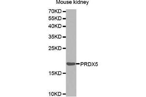 Western Blotting (WB) image for anti-Peroxiredoxin 5 (PRDX5) (AA 53-214) antibody (ABIN6216418) (Peroxiredoxin 5 抗体  (AA 53-214))