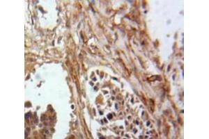 IHC-P analysis of Ovary tissue, with DAB staining. (Inhibin alpha 抗体  (AA 25-363))