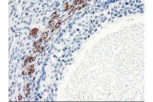 Immunohistochemistry (IHC) image for anti-ELK3, ETS-Domain Protein (SRF Accessory Protein 2) (ELK3) antibody (ABIN1498005) (ELK3 抗体)