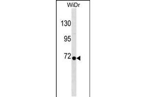 Western blot analysis in WiDr cell line lysates (35ug/lane). (RPN1 抗体  (C-Term))