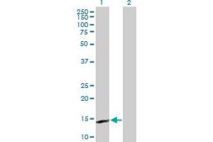 Western Blot analysis of IL15 expression in transfected 293T cell line by IL15 MaxPab polyclonal antibody. (IL-15 抗体  (AA 1-162))