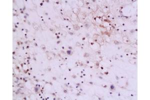 Immunohistochemistry (IHC) image for anti-Interleukin 13 (IL13) (AA 45-56) antibody (ABIN670116)