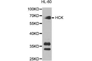 Western blot analysis of extracts of HL-60 cell lines, using HCK antibody. (HCK 抗体  (AA 1-220))