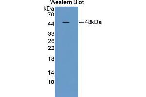 Western blot analysis of the recombinant protein. (TGFBR2 抗体  (AA 209-590))