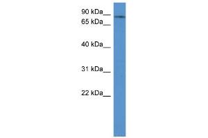 WB Suggested Anti-ADD3 Antibody Titration: 0. (ADD3 抗体  (C-Term))