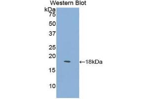 Western blot analysis of the recombinant protein. (LY96 抗体  (AA 16-160))