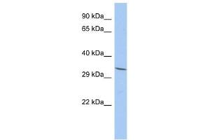 FAM78A antibody used at 1 ug/ml to detect target protein. (FAM78A 抗体  (N-Term))