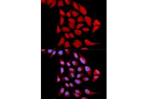 Immunofluorescence analysis of U2OS cells using PSMA6 antibody. (PSMA6 抗体)