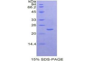 SDS-PAGE (SDS) image for Fas (TNFRSF6)-Associated Via Death Domain (FADD) (AA 7-178) protein (His tag) (ABIN2124767) (FADD Protein (AA 7-178) (His tag))