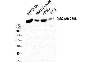 Western Blot analysis of HepG2-UV Mouse-BRAIN AD293 PC-3 cells using RyR-2 Polyclonal Antibody diluted at 1:2000. (RYR2 抗体)