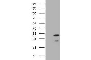 Image no. 2 for anti-Membrane-Spanning 4-Domains, Subfamily A, Member 1 (MS4A1) antibody (ABIN1497207) (CD20 抗体)