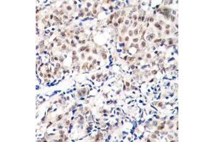 Immunohistochemistry (IHC) image for anti-Cyclin-Dependent Kinase Inhibitor 1B (p27, Kip1) (CDKN1B) (pThr187) antibody (ABIN3020148) (CDKN1B 抗体  (pThr187))