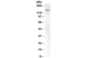 Western blot testing of HeLa cell nuclear lysate with SENP6 antibody at 0. (SENP6 抗体)