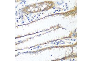 Immunohistochemistry of paraffin-embedded human stomach using PPP4R1 antibody (ABIN5974671) at dilution of 1/100 (40x lens). (PPP4R1 抗体)