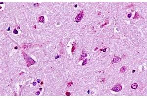 Human, Brain, neurons: Formalin-Fixed Paraffin-Embedded (FFPE) (LGR5 抗体  (Cytoplasmic Domain))