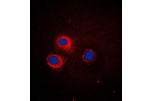 Immunofluorescent analysis of CD1e staining in HeLa cells. (CD1e 抗体  (Center))