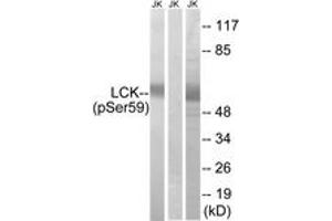 Western blot analysis of extracts from Jurkat cells treated with IFN 2500U/ML 30', using LCK (Phospho-Ser59) Antibody. (LCK 抗体  (pSer59))