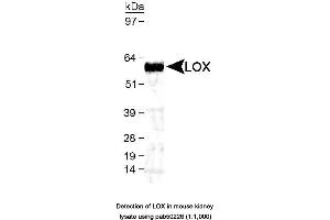 Image no. 1 for anti-Lysyl Oxidase (LOX) (AA 200-300), (AA 300-400) antibody (ABIN363535) (LOX 抗体  (AA 200-300, AA 300-400))