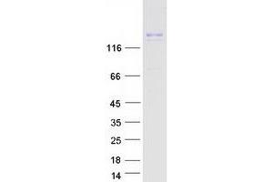 Validation with Western Blot (INSRR Protein (Myc-DYKDDDDK Tag))