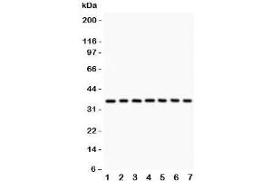 Western blot testing of IkBa antibody and Lane 1:  rat brain;  2: mouse brain;  3: (r) kidney;  4: (m) kidney;  5: human 293T;  6: (h) Jurkat;  7: (h) Raji lysate. (NFKBIA 抗体  (AA 3-112))