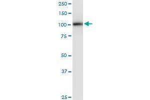 PLD2 monoclonal antibody (M01), clone 1C5. (Phospholipase D2 抗体  (AA 834-933))