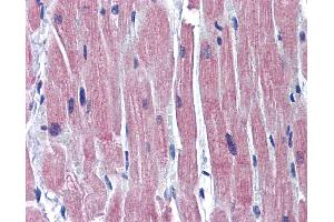 Anti-TNNI3 / CTnI antibody IHC of human heart. (TNNI3 抗体  (C-Term))