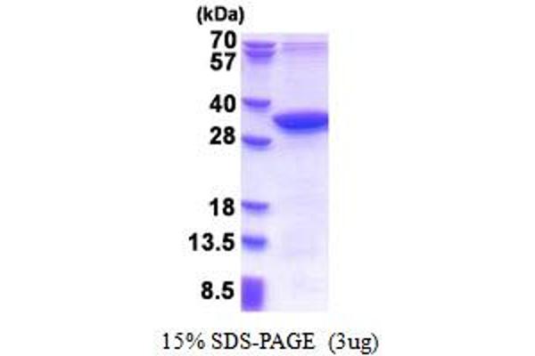 MMADHC Protein (AA 39-296) (His tag)