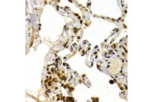 Immunohistochemistry of paraffin-embedded human lung using DP1/DP1/TFDP1 antibody (ABIN6130313, ABIN6149038, ABIN6149040 and ABIN6221075) at dilution of 1:200 (40x lens). (DP1 抗体  (AA 1-290))