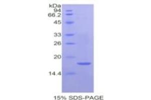 SDS-PAGE of Protein Standard from the Kit  (Highly purified E. (Hemopexin ELISA 试剂盒)