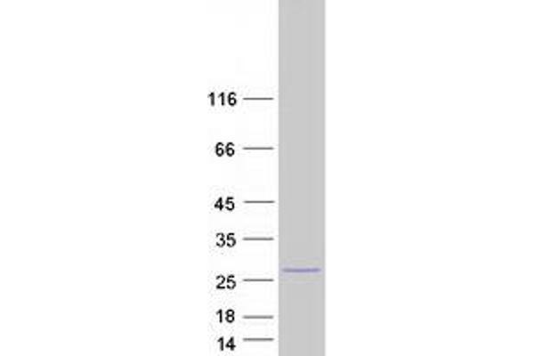 Leucine Rich Transmembrane and 0-Methyltransferase Domain Containing (LRTOMT) (Transcript Variant 1) protein (Myc-DYKDDDDK Tag)