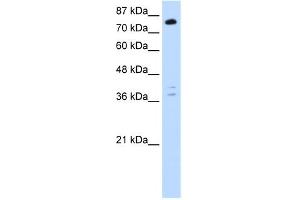 WB Suggested Anti-TSC22D2 Antibody Titration:  0. (TSC22D2 抗体  (C-Term))