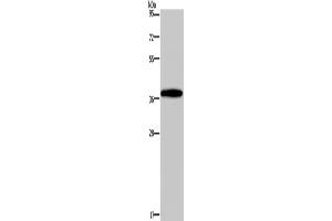 Western Blotting (WB) image for anti-Distal-Less Homeobox 4 (DLX4) antibody (ABIN2429948) (DLX4 抗体)