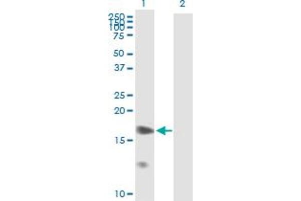 Prostaglandin E Synthase 抗体  (AA 1-152)