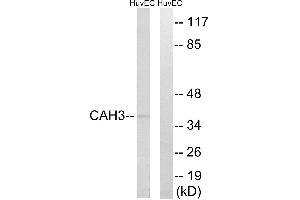 Western blot analysis of extracts from HUVEC cells, using CA3 antibody. (CA3 抗体)
