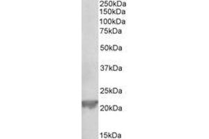 Image no. 1 for anti-Glutathione Peroxidase 1 (GPX1) (AA 11-21) antibody (ABIN1101865) (Glutathione Peroxidase 1 抗体  (AA 11-21))