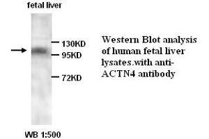 Image no. 1 for anti-Actinin, alpha 4 (ACTN4) antibody (ABIN1574447) (alpha Actinin 4 抗体)