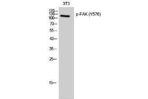 Western Blotting (WB) image for anti-PTK2 Protein tyrosine Kinase 2 (PTK2) (pTyr576) antibody (ABIN3179639) (FAK 抗体  (pTyr576))