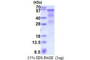 SDS-PAGE (SDS) image for Heparanase (HPSE) (AA 36-543) protein (His tag) (ABIN5853551) (HPSE Protein (AA 36-543) (His tag))