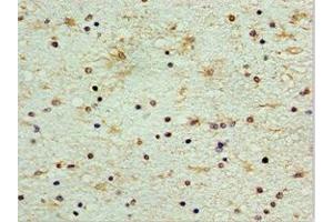 Immunohistochemistry of paraffin-embedded human brain tissue using ABIN7148846 at dilution of 1:100 (CDK1 抗体  (AA 1-283))