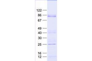 Validation with Western Blot (ZFP37 Protein (His tag))