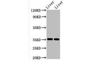 Western Blotting (WB) image for anti-Arginase, Liver (ARG1) (AA 1-322) antibody (ABIN6091458) (Liver Arginase 抗体  (AA 1-322))