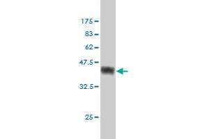 Western Blot detection against Immunogen (38. (PRKACA 抗体  (AA 1-120))