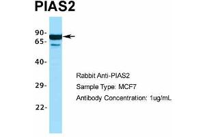 Host:  Rabbit  Target Name:  PIAS2  Sample Type:  MCF7  Antibody Dilution:  1. (PIAS2 抗体  (C-Term))