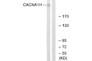 Western blot analysis of extracts from A549 cells, using CACNA1H antibody. (CACNA1H 抗体  (Internal Region))