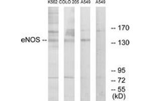 Western blot analysis of extracts from A549/K562/COLO205 cells, using eNOS (Ab-1179) Antibody. (ENOS 抗体  (AA 1145-1194))