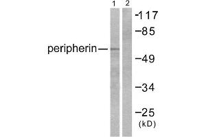 Western Blotting (WB) image for anti-Peripherin (PRPH) (C-Term) antibody (ABIN1848741) (Peripherin 抗体  (C-Term))