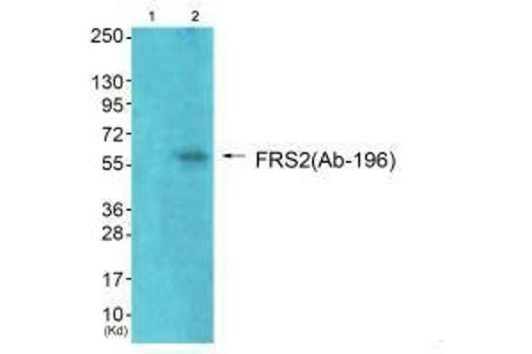 FRS2 抗体  (Tyr196)