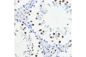 Immunohistochemistry of paraffin-embedded mouse testis using ZEB1 antibody (ABIN6129933, ABIN6150422, ABIN6150423 and ABIN6221237) at dilution of 1:200 (40x lens). (ZEB1 抗体  (AA 1-260))