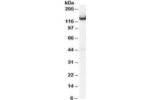 Western blot testing of mouse brain lysate with Amphiphysin antibody at 0. (Amphiphysin 抗体)